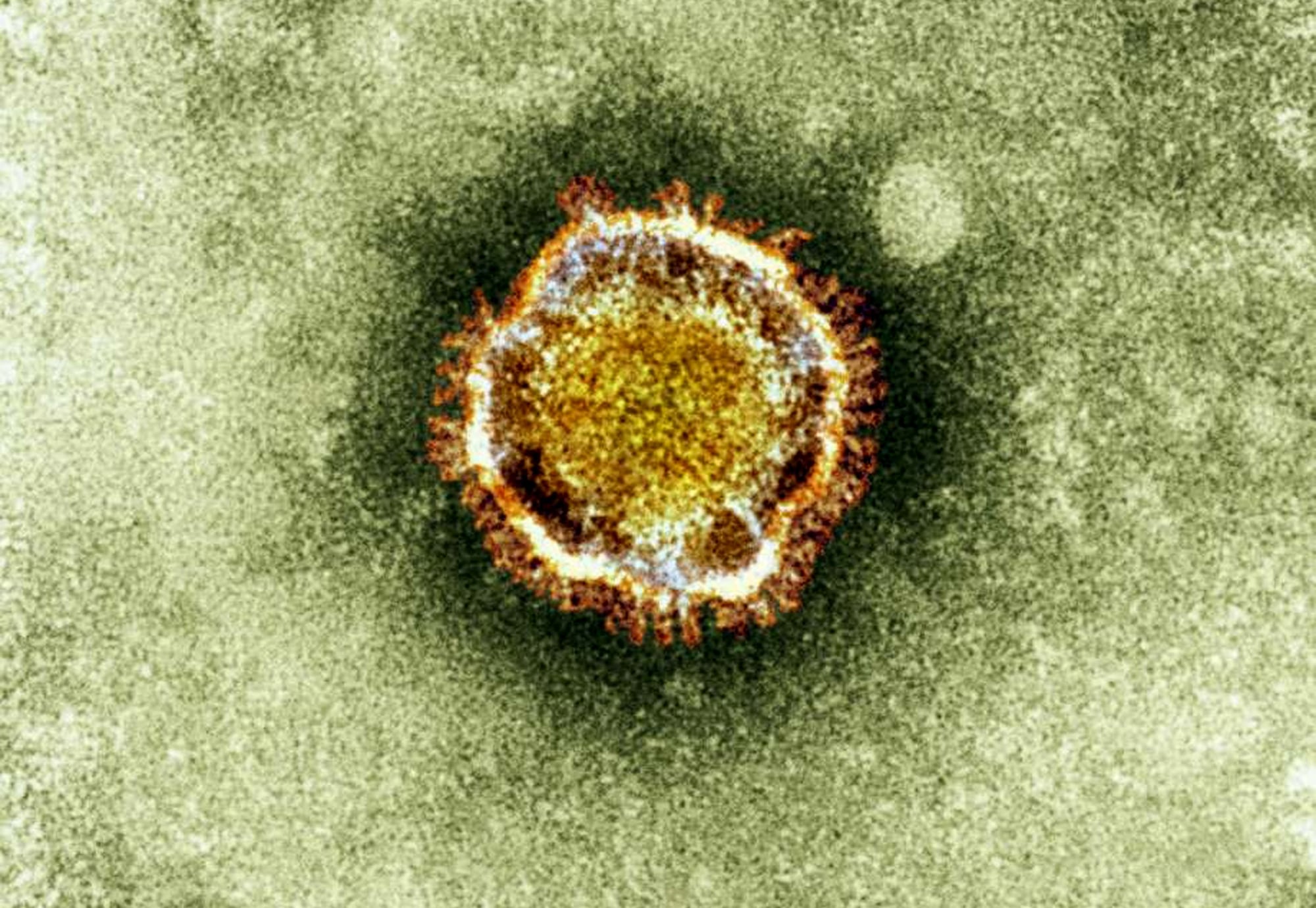 An electron microscope image of a coronavirus, part of a family of viruses that cause ailments including the common cold and SARS, which was first identified last year in the Middle East.